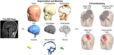 Template MRI scans reliably approximate individual and group-level tES and TMS electric fields induced in motor and prefrontal circuits